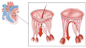 Detail of tricuspid valve.